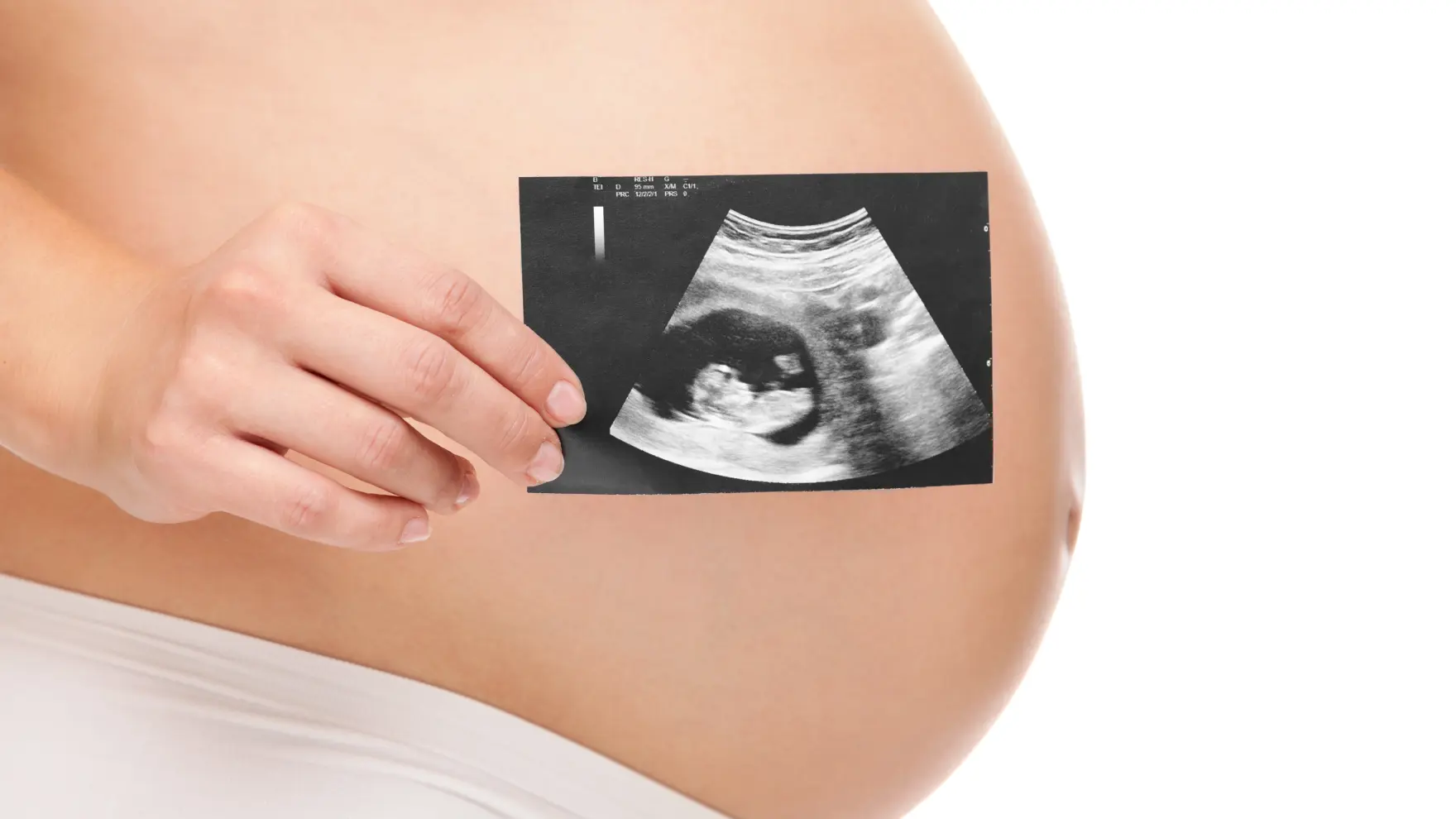 Bảo Hiểm Thai Sản Là Gì? Quyền Lợi Mẹ Bầu Cần Biết Khi Sinh Con
